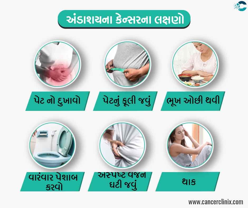 અંડાશયના કેન્સરના મુખ્ય લક્ષણો (Key Symptoms)
