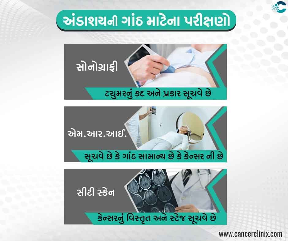 અંડાશયની ગાંઠ માટેના મુખ્ય પરીક્ષણો (Diagnostic Protocol)
