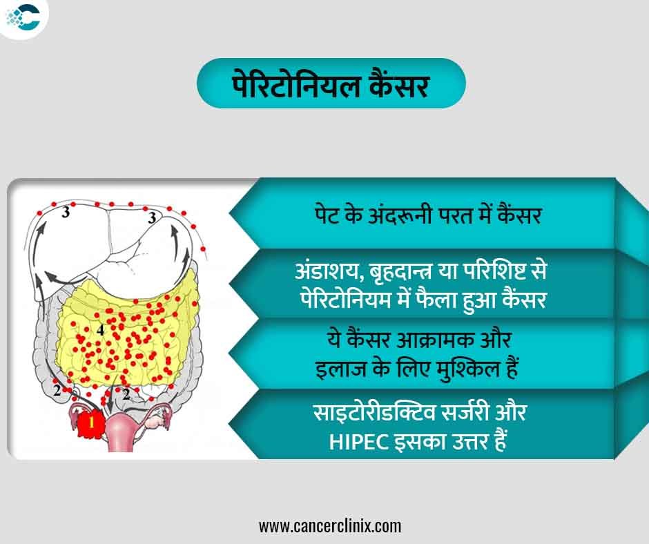 अहमदाबाद के शाह्स कैंसर सेंटर में एक महिला मरीज और उनके परिवार को डिजिटल स्क्रीन पर पेट की पेरिटोनियम झिल्ली और पेरिटोनियल कैंसर की स्थिति समझाते हुए वरिष्ठ विशेषज्ञ।
