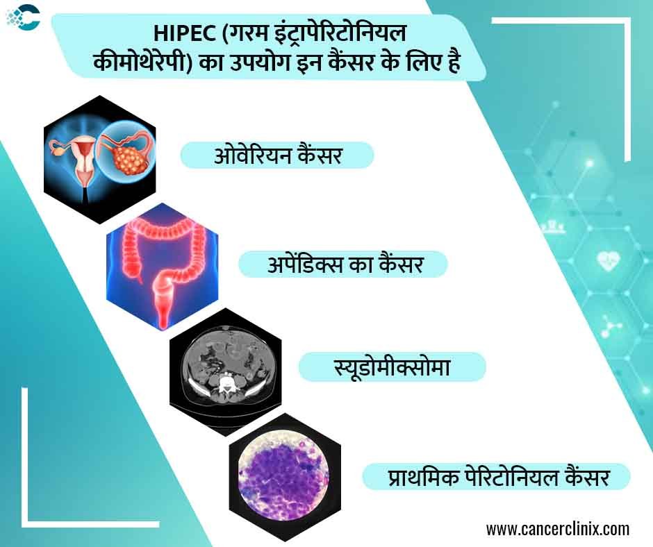 अहमदाबाद के शाह्स कैंसर सेंटर में एडवांस ओवेरियन कैंसर के मरीज और उनके परिवार को डिजिटल प्रेजेंटेशन के जरिए गर्म इंट्रापेरिटोनियल कीमोथेरेपी (HIPEC) की पूरी कार्यप्रणाली समझाते हुए वरिष्ठ ऑन्को-सर्जन।
