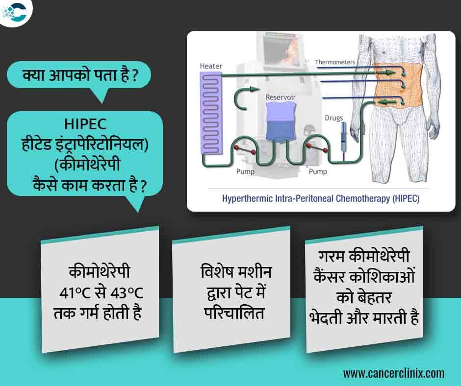 अहमदाबाद के शाह्स कैंसर सेंटर में एक महिला मरीज और उनके परिवार को डिजिटल चार्ट के माध्यम से हाइपेक (HIPEC) थेरेपी के मिथकों और वैज्ञानिक सच्चाई के बारे में समझाते हुए वरिष्ठ ऑन्कोलॉजिस्ट।
