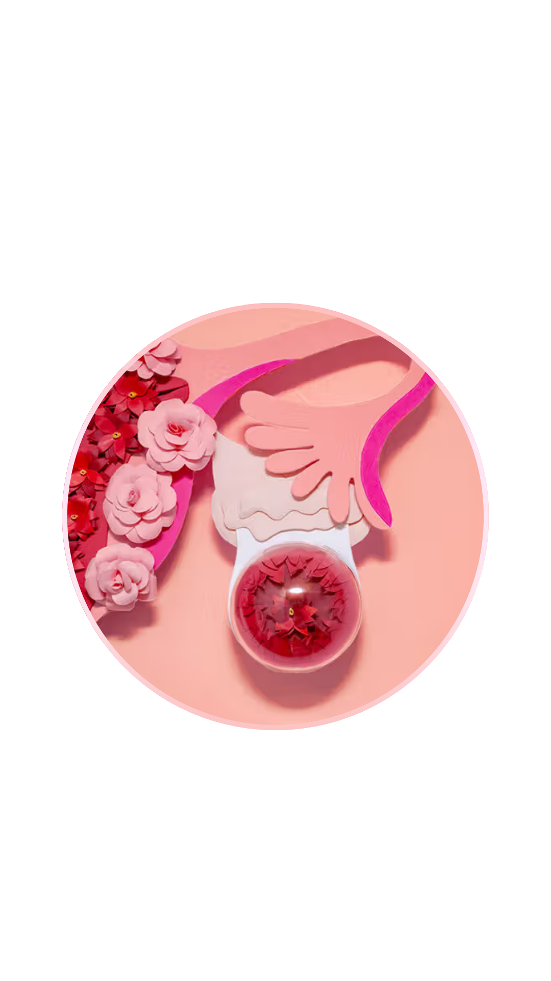 Early Ovarian Cancer