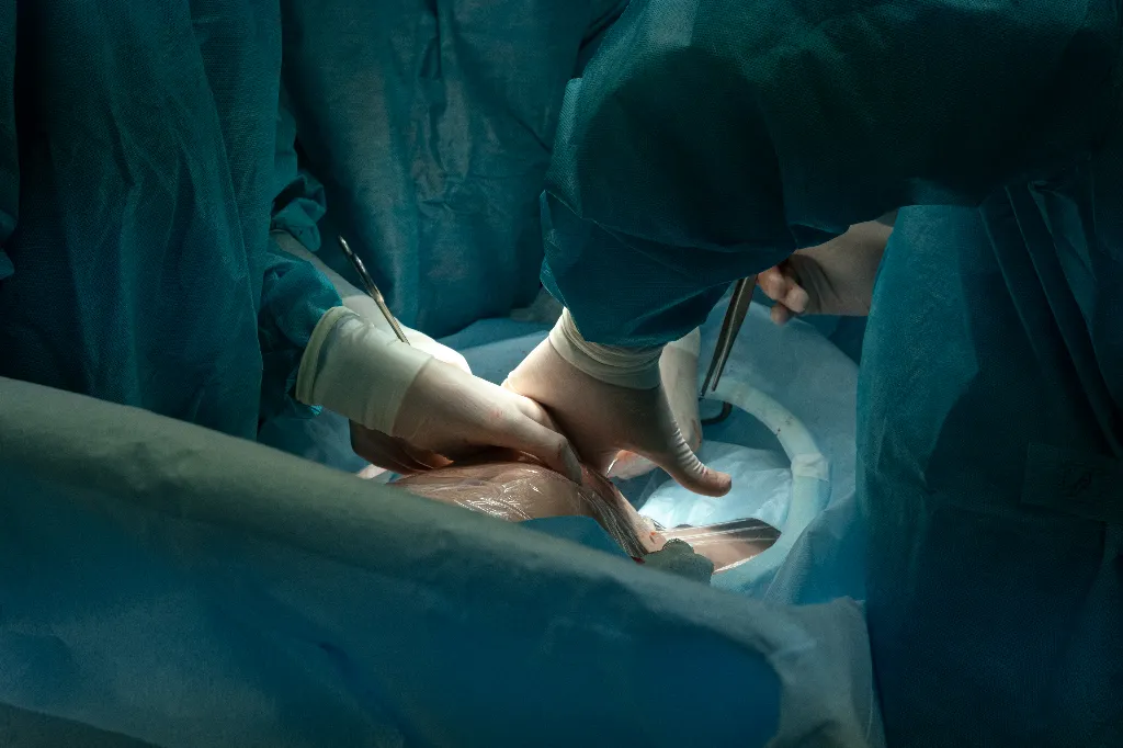Role of Surgery